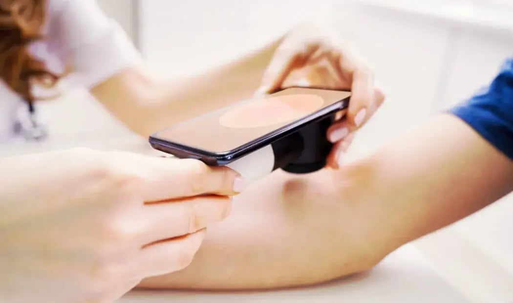 testing for melanoma using a high tech hand-held device
