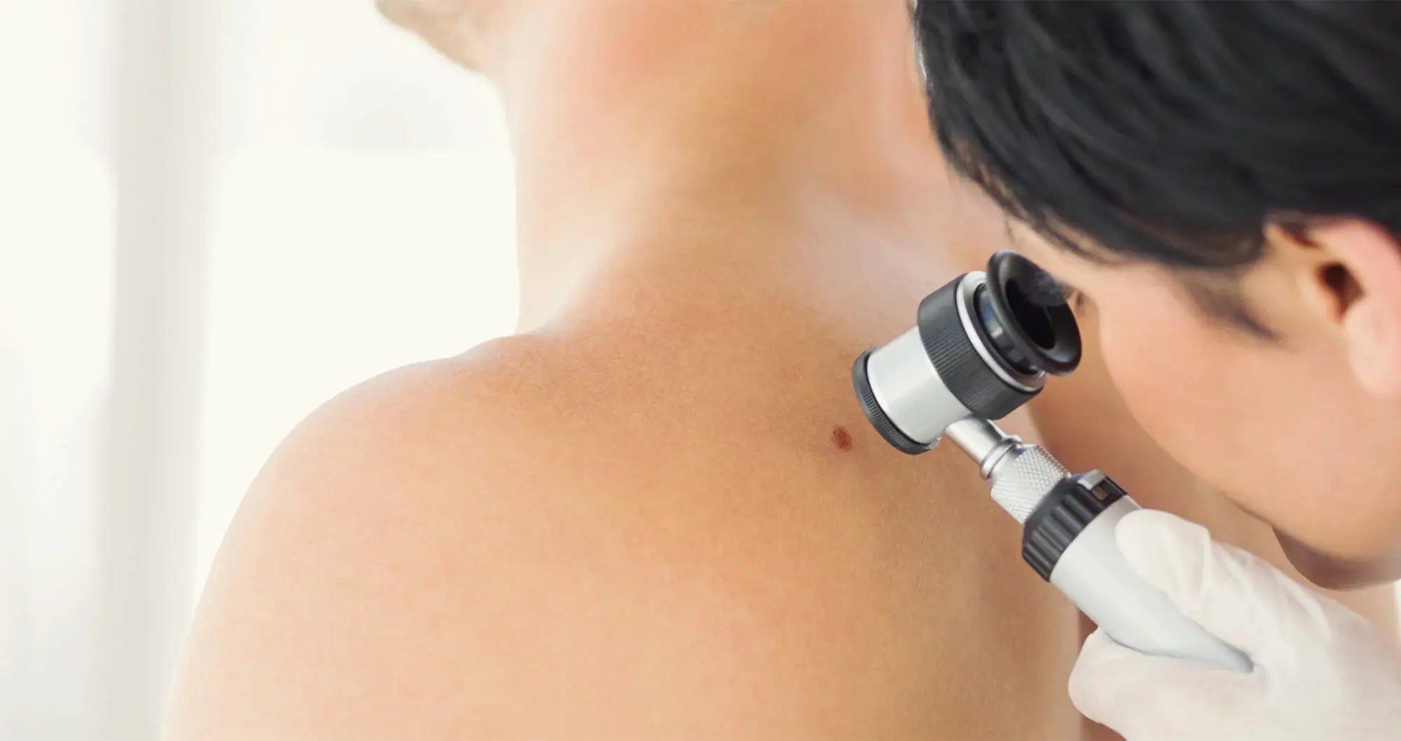 inspection of a skin blemish for melanoma